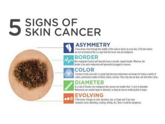 Рак кожи - симптомы, профилактика, лечение