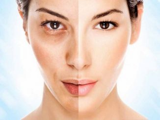 Удаление черных точек - домашние маски и методы очищения лица